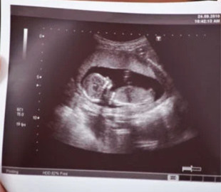 У дистанційному режимі: як відкрити лікарняний по вагітності під час війни