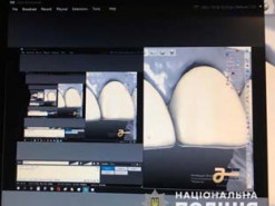 На Днепропетровщине хакеры наживались на стоматологах