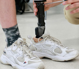 Нідерландська лабораторія поділилася з українськими фахівцями досвідом 3D-протезування