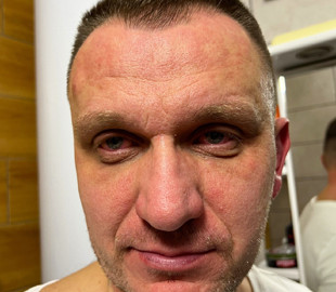 На львівського інженера, який ремонтує Starlink для фронту, напали невідомі. Зловмисники представилися місцевою ТРО