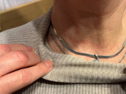 У Києві грабіжники мало не вбили матір військовополоненого