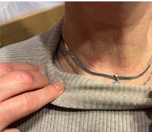 У Києві грабіжники мало не вбили матір військовополоненого