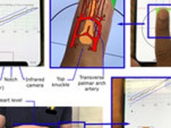 Для iPhone X создали приложение, способное измерять кровяное давление