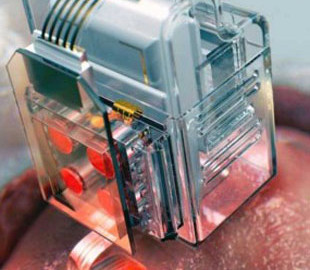 Специалисты научились доставлять лекарства прямо в мозг с помощью смартфона