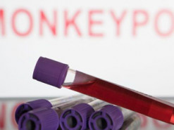 У Європі зафіксували нову смерть від віспи мавп: де саме