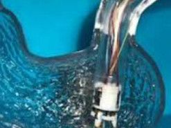 Разработана технология восстановления желудка методом 3D-печати