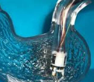 Разработана технология восстановления желудка методом 3D-печати