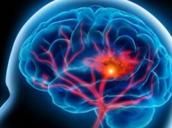 Исследование: 3D-платформеры могут защитить от болезни Альцгеймера