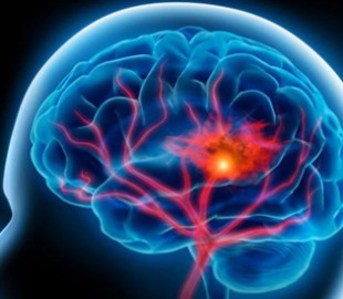 Исследование: 3D-платформеры могут защитить от болезни Альцгеймера