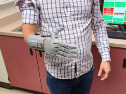 Школьники из США сделали протез с открытым исходным кодом