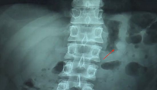 212961442-6981233-image-m-10_1556723832445.jpg (16 KB)