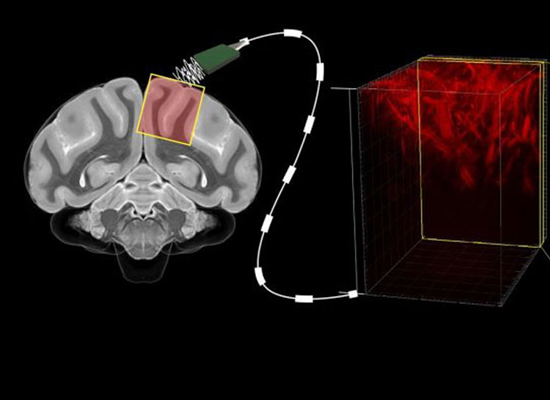 Ultrasound-Brain-Machine-In.jpg (90 KB)