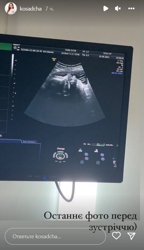 3iaKSZnwei5WJaqU3GHpz90rnnFeMn5zvOGPeN0n1.jpg (42 KB)