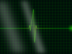 Смартфон научили делать электрокардиограмму