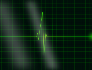 Смартфон научили делать электрокардиограмму