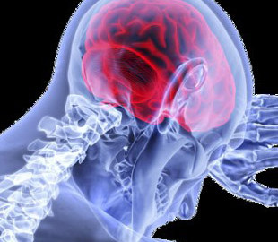 Ученые создали мозговой имплант, который обнаруживает и устраняет боль в реальном времени