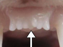 Японський стартап створив засіб для вирощування нових зубів