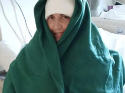 Мозковий чип від Neuralink дозволив паралізованій жінці писати й малювати силою думки