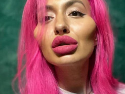 Блогерша з аномально круглими щоками показала фото до пластики обличчя