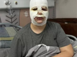 У Львові троє дітей постраждали від вибухівки, виготовленої за інструкцією з TikTok