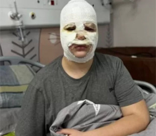 У Львові троє дітей постраждали від вибухівки, виготовленої за інструкцією з TikTok