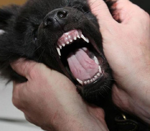 Підозрюють сказ: у Житомирській області померла 25-річна жінка