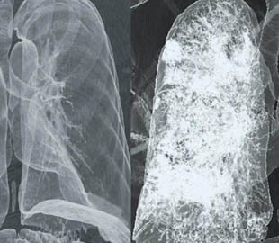 Учені створили для смартфонів безпечний аналог рентгенівського зору