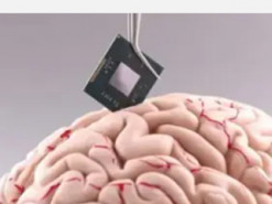 Ілон Маск планує вживити мозковий чип Neuralink трьом людям у 2025 році