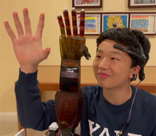 Школяр створив протез руки за $300, який керується думками