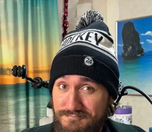 Рік з чипом у мозку: пацієнт Neuralink розповів, як почуває себе і чи має побічні ефекти