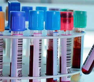 Netflix випустив документальний серіал про коронавірус