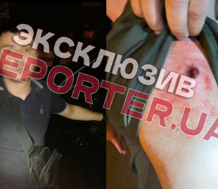 Назвал сепаратистом: в Днепре на Паникахи в мужчину дважды выстрелили из пистолета