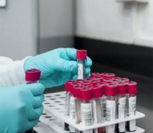 Імунолог назвав симптоми нових штамів коронавірусу