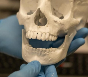 У Чехії розробляють технологію 3D-друку кісток
