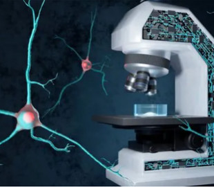 Мікроскоп на основі ШІ передбачає утворення хвороб мозку - дослідження