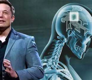 Чіп у голові: як технологія Neuralink вже дозволяє людям керувати гаджетами силою думки