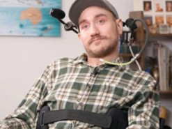 Перший користувач мозкового імпланту поділився своїм досвідом життя