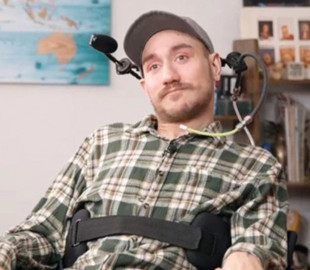 Перший користувач мозкового імпланту поділився своїм досвідом життя