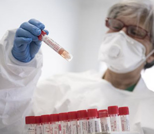 Як відрізнити віспу мавп від "корони": ці поради можуть врятувати життя