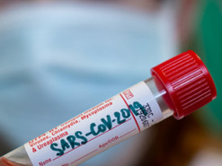 МОЗ Туреччини запустило онлайн-тест на виявлення коронавірусу