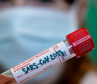 МОЗ Туреччини запустило онлайн-тест на виявлення коронавірусу