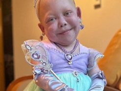 У Канаді померла 10-річна TikTok-зірка, яка боролася з трьома вродженими хворобами