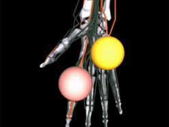 Штучний інтелект Meta може допомогти лікарям розробити найкращі протези