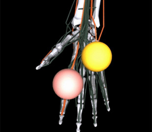 Штучний інтелект Meta може допомогти лікарям розробити найкращі протези
