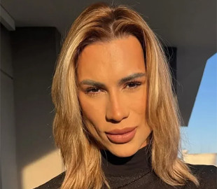 Блогер із Бразилії помер через ускладнення після пластики очей