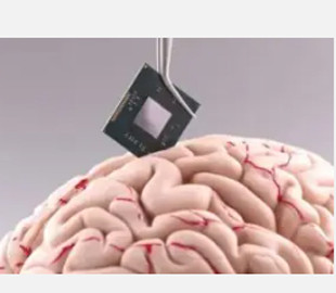 Пацієнт з імплантом Neuralink навчився керувати роботом одними думками