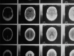 Штучний інтелект від Microsoft перевершив лікарів у діагностиці складних захворювань