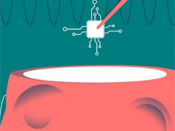 Перший користувач Neuralink описує плюси та мінуси життя з мозковим чіпом