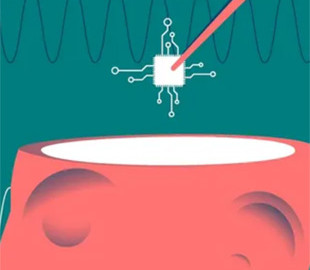 Перший користувач Neuralink описує плюси та мінуси життя з мозковим чіпом