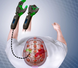 Устройство с интерфейсом «мозг-компьютер» впервые разрешили использовать для лечения в США
